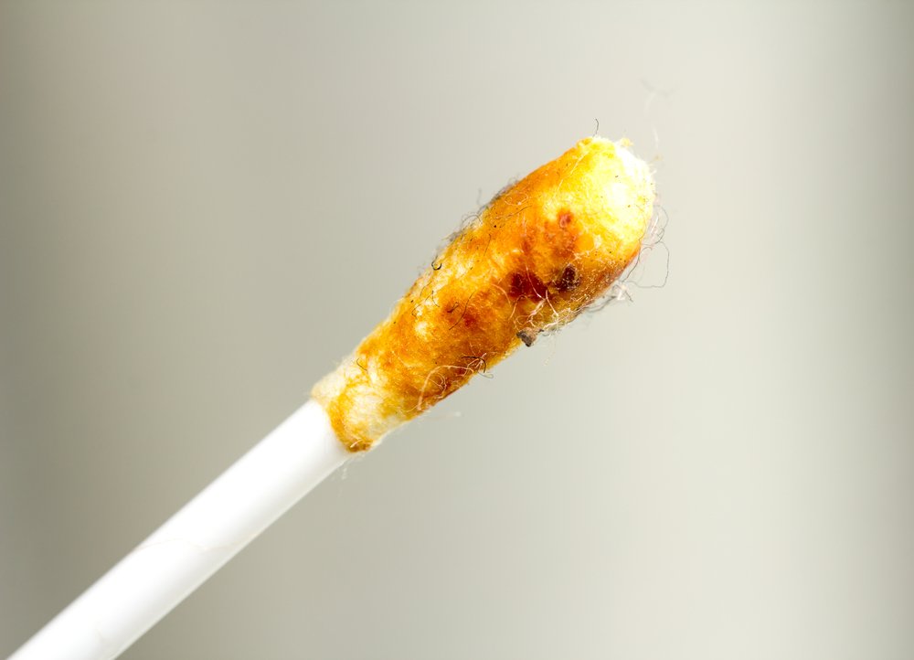 How to Professionally Remove Ear Wax