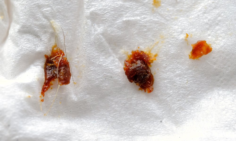 What is Earwax Made of