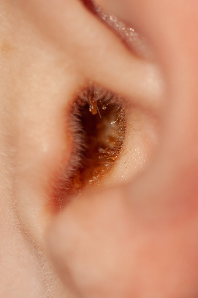 What Does Earwax Color Mean?
